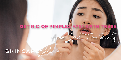 5 In a single day DIY Zits Spot Therapies and Merchandise 5 In a single day DIY Zits Spot Therapies and Merchandise