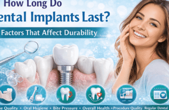How Lengthy Do Dental Implants Final? 6 Elements That Have an effect on Sturdiness