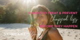 Chapped Lips Remedies | Prevention and Dwelling Treatments