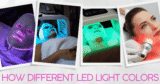 How Totally different LED Mild Colours Help Collagen, Zits Therapeutic & Anti-Growing older