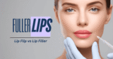 Lip Flip vs Lip Filler: What’s the Distinction?