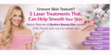 Uneven Pores and skin Texture? 5 Laser Remedies That Can Assist Easy Your Pores and skin